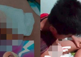 Kronologi Alat Vital Bocah di Jambi Terpotong saat Sunat Laser, Alami Luka Serius sampai Orang Tua Curiga Ada Malpraktik