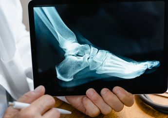 Benarkah Kedua Kaki Kita Ukurannya Berbeda? Ternyata Ini Faktanya