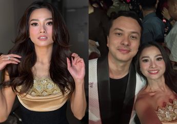 Dua Dekade Lalu Pernah Casting Film Bareng, Acha Septriasa Tak Ragu Puji Paras Nicholas Saputra: Damagenya Sama!