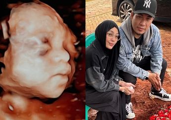 Baru Keluar RS, Istri Rizal Armada Langsung Lari ke Makam, Monica Imas Sapa Bidadari Surganya