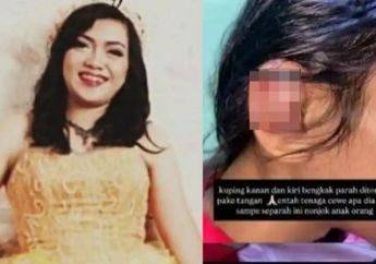 Kronologi ASN di Bogor Siksa ART Gegara Matikan Kompor, Korban Ngaku Alami Kekerasan Sejak 6 Bulan Terakhir!