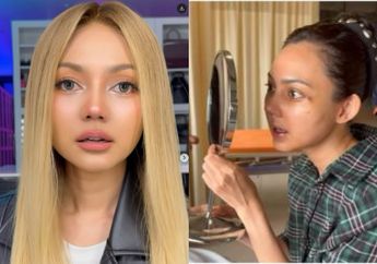 Profil Rina Nose, Artis yang Putuskan Oplas Hidung dengan Dokter Tompi, Bantah Ikuti Tren Kecantikan!