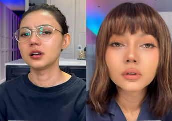 Rina Nose Blak-blakan Operasi Hidung dan Mata Sekaligus, Ternyata Ini Alasan Sebenarnya!