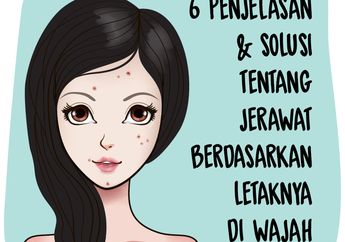 6 Penjelasan & Solusi Tentang Jerawat Berdasarkan Letaknya Di Wajah