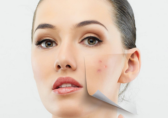 Terungkap Sudah, Ini Penyebab dan Cara Menghilangkan Vlek Hitam di Wajah 