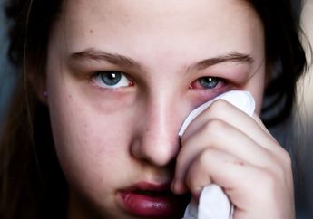 Jangan Anggap Sepele 5 Penyebab  Mata Bengkak Tanpa Menangis, Nomor 4 Ngeri Juga Ternyata!