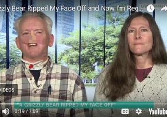 Diserang Beruang dan Kehilangan Hidungnya, Pria Ini Justru Dihujat Netizen