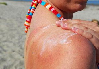 Waduh, Kulit Masih Terbakar Meski Pakai Tabir Surya, Ini Dia Sebabnya
