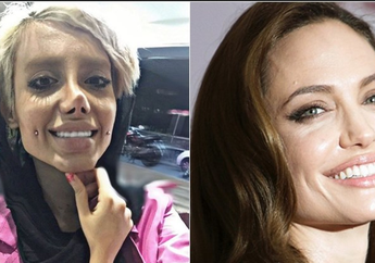 Fenomena Gadis Asal Iran Operasi Plastik 50 Kali Demi Mirip Artis Angelina Jolie, Apa Dampak Buruknya? Ini Kata Pakar