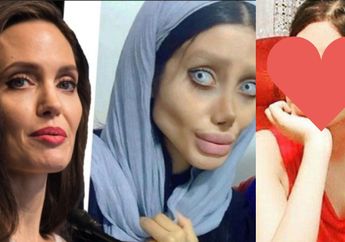 Terungkap! Ini Dia Wajah Asli Wanita yang Telah Menipu Jutaan Orang di Dunia Karena Mengaku Operasi Berpuluh-puluh Kali Agar Mirip Angelina Jolie