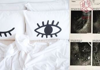 Bikin Merinding! Nggak Cuci Sarung Bantal Selama 5 Tahun, Dokter Temukan Hal Mengerikan di Bulu Mata Wanita ini