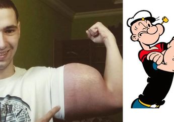 Dipanggil Si Popeye dari Rusia, Awalnya Bangga, Kini Terancam Kehilangan Tangan di Usia Muda