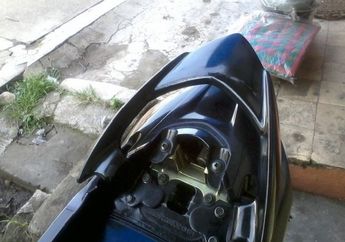 Bukan Cuma Gigi Manusia, Motor pun Perlu Pakai Behel loh! Ternyata Ini Fungsinya yang Sering Kita Remehkan