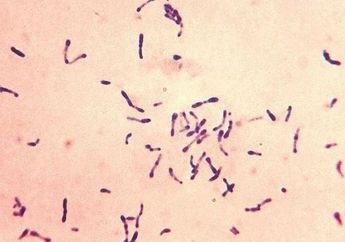 Lagi Heboh Nih Soal Penyakit Difteri, Kepoin Yuk Soal Apa, Gejala dan Pemicunya