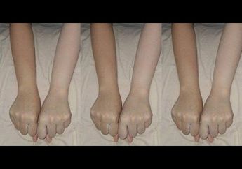 Nggak Pake Ribet, yuk Intip Cara Membuat Ramuan Bleaching yang Aman Bagi Kulitmu