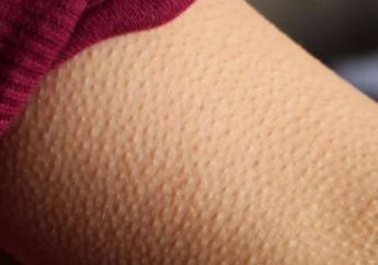 Saat Dengarkan Musik Bulu Kudukmu Berdiri? Ini Penjelasannya