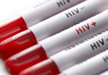 Benarkah HIV/AIDS Sebabkan Kemandulan? Simak Penjelasannya Berikut Ini