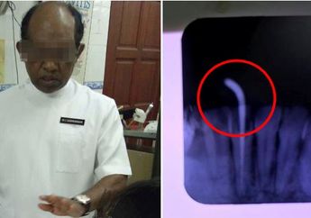 Ngeri, Wanita Memasang Kawat Gigi Namun Malah Menjadi Keluar Nanah dan Giginya Hancur Berantakan! 