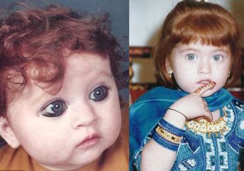 Bayi dari India Berambut Merah dan Berkulit Putih Sampai Dibully Teman-temannya, Tak Disangka Saat Dewasa Cantiknya Luar Biasa! Inikah Penyebabnya?