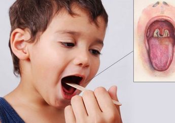 Orang Tua Harus Tahu, Begini Cara Penularan Wabah Difteri Pada Si Kecil