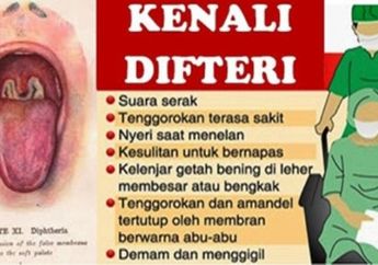 Ternyata Inilah Penyebab Penyakit Difteri, Orang Tua Millennials Harus Baca 