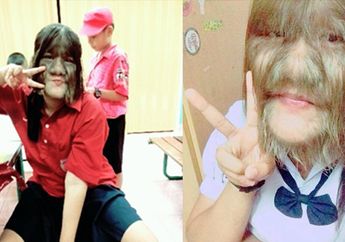 Masih Ingat Muka Penuh Bulu 'Manusia Serigala'? Tumbuh Dewasa dan Punya Pasangan, Wajahnya Kini Sudah Mulus