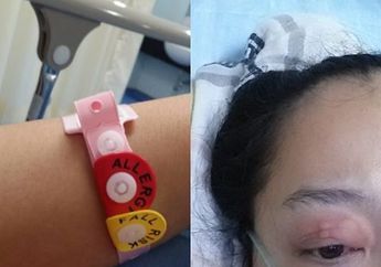 Sebelum Meninggal, Dokter Ungkapkan Kondisi Renita Sukardi yang Turun Drastis Sejak Semalam