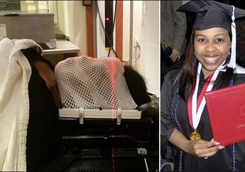 Sedang Hamil, Wajah Wanita Ini Alami Mati Rasa, Sebabnya Sungguh Mengejutkan! Ada Apa Kira-kira?