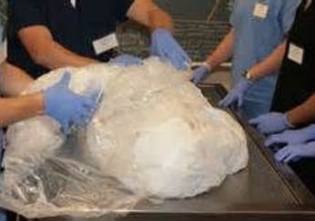 Dinyatakan Meninggal Oleh 3 Dokter, Pria Ini Kembali Hidup Saat Akan Diautopsi!