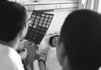 Demam Selama Bertahun-tahun, Ternyata Ada Cabai Rawit di Paru-paru Wanita Ini