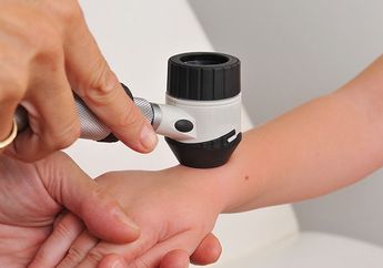 WOW! Jarang Diketahui, Ternyata Krim Ini Ampuh Untuk Perangi Kanker Kulit