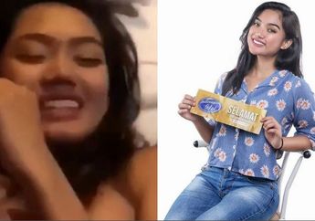 Beredar Video Mesum, Marion Jola Mengaku Pernah Operasi Pelastik