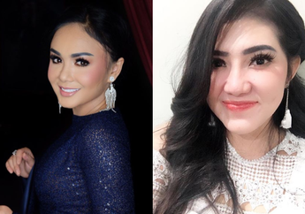 Bertemu Via Vallen, Nggak Nyangka Yuni Shara Beberkan Umurnya!