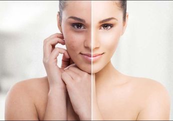 Waspadai Warna Kulit yang Berubah, Bukan Cuma Karena Matahari, Bisa Jadi Ini Penyebabnya!