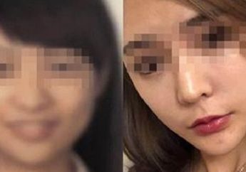 Usai Jalani Operasi Plastik, Seorang Wanita Ditolak Maskapai Penerbangan Lantaran Wajahnya Berbeda dari Foto Paspor