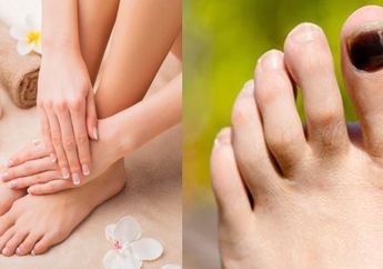 Hati-Hati Potong Kuku Kaki, Kalau Salah Bisa Tumbuh ke Dalam, Ini Cara yang Tepat