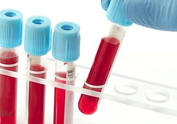 Tes Darah &lsquo;Holy Grail&rsquo;, Temuan Baru Untuk Ketahui Kanker Lebih Cepat, Seperti Apa ya?