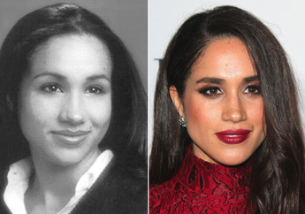 Meghan Markle Calon Istri Pangeran Harry Dikabarkan Gunakan Alternatif Suntik Botoks Seharga 89 Dolar Amerika, Kamu Berminat? 