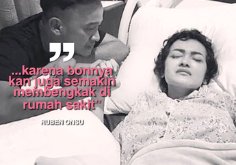 Tagihan Rumah Sakit Julia Perez Besar, Rencana Berobat Ke Jepang Kandas