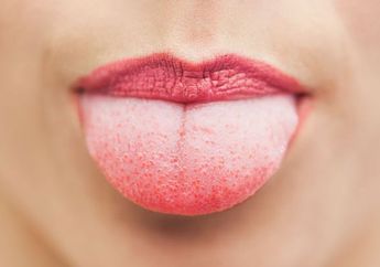 Ini 4 Bahan Alami yang Ampuh Atasi Lidah yang Melepuh Karena Makanan Panas