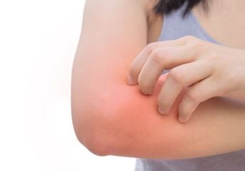 Kesal dengan Ruam Kulit? Bahan Rumahan Ini Ampuh Banget Mengatasinya