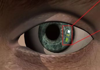 Wah Ada Lensa Kontak Cerdas dengan Sensor Kadar Glukosa, Solusi Untuk Penderita Diabetes nih!