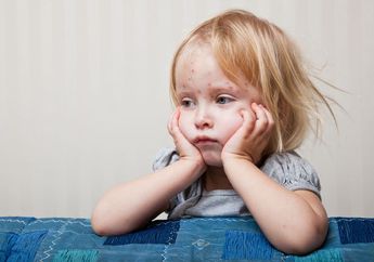 Penyakit Campak Bisa Mematikan Loh! Kenali Gejala, Pengobatan, dan Cara Pencegahan Agar Si Kecil Terhindar