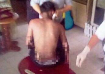 Gila, Seorang Pria Nekat Membakar Dirinya Sendiri di Rumah Pacarnya