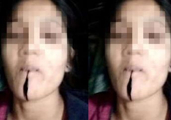 Gara-gara Mantan, Calon Pengantin Wanita Tenggak Racun Sebelum Hari Pernikahan