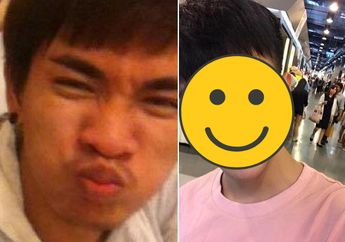 Oplas Puluhan Kali, Pria Ini Pengen Mirip Minho SHINee, Cek Hasilnya!