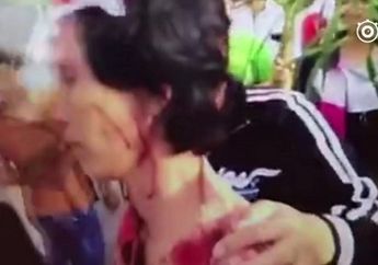 Tak Sengaja Menodai Sepatu Mahal Milik Pejalan Kaki, Petugas Sanitasi Dianiaya