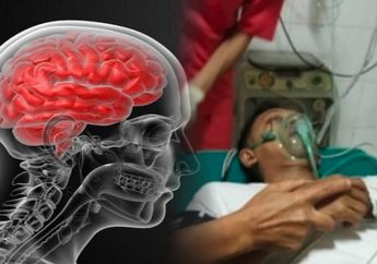 Mengenal Mati Batang Otak, Diagnosa Pada Guru SMAN 1 Torjun Sampang Sebelum Meninggal