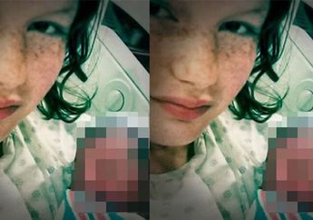 Tega! Orang Tua Biarkan Bayinya yang Berusia 15 Hari Digigit Tikus