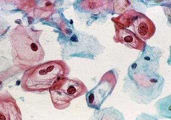 Kenali 6 Tanda Peringatan Kanker Serviks yang Pantang Kamu Abaikan